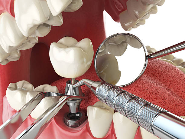 Best Emergency Treatment for Oral Infections in Indian Hills, TX